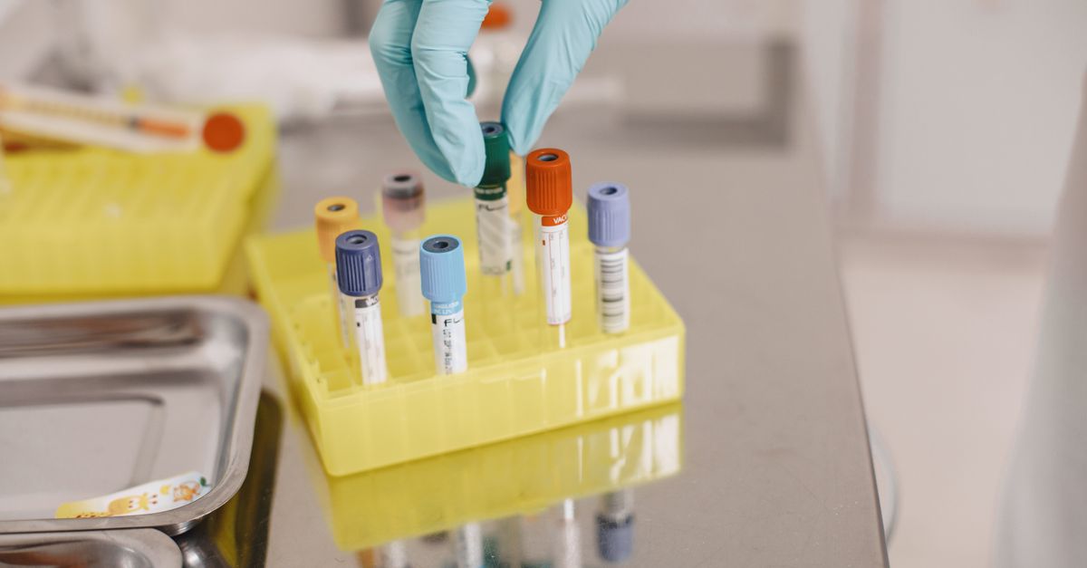Échographie abdominale : quels organes elle explore et comment se préparer - Laboratoire Le Clair de la Plume Douala