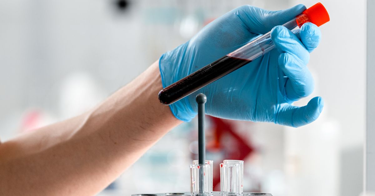 Vitamine B12 et folates : la carence qui imite la fatigue et la dépression - Laboratoire Le Clair de la Plume Douala